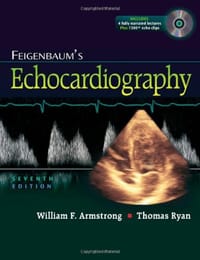 Feigenbaum&#x27;s Echocardiography