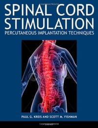 Spinal Cord Stimulation