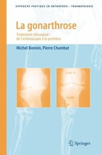 La gonarthrose