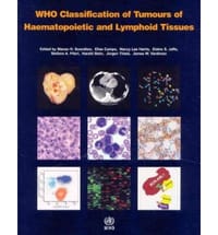 WHO Classification of Tumours of Haematopoietic and Lymphoid Tissues