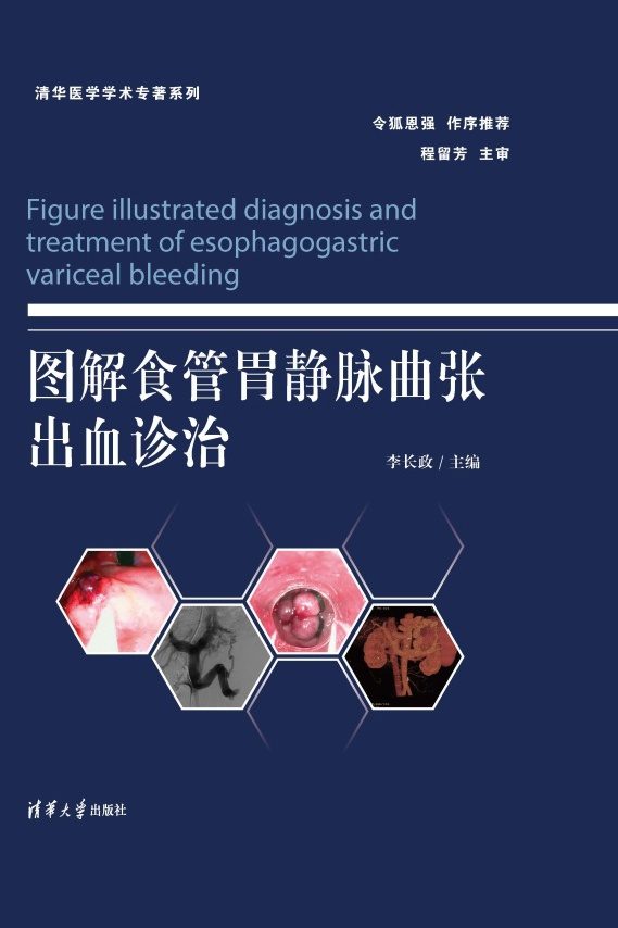 图解食管胃静脉曲张出血诊治